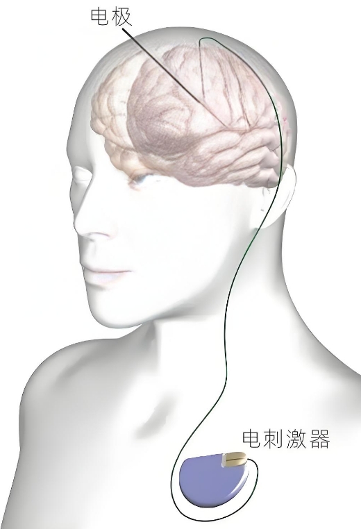 1750988187255420.png DBS.png