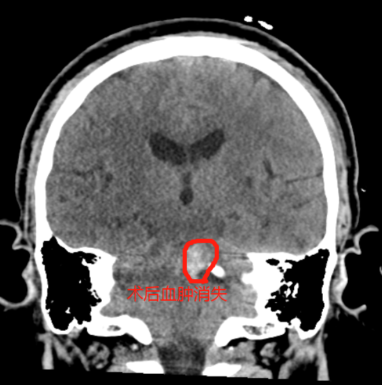 640 (3).png
